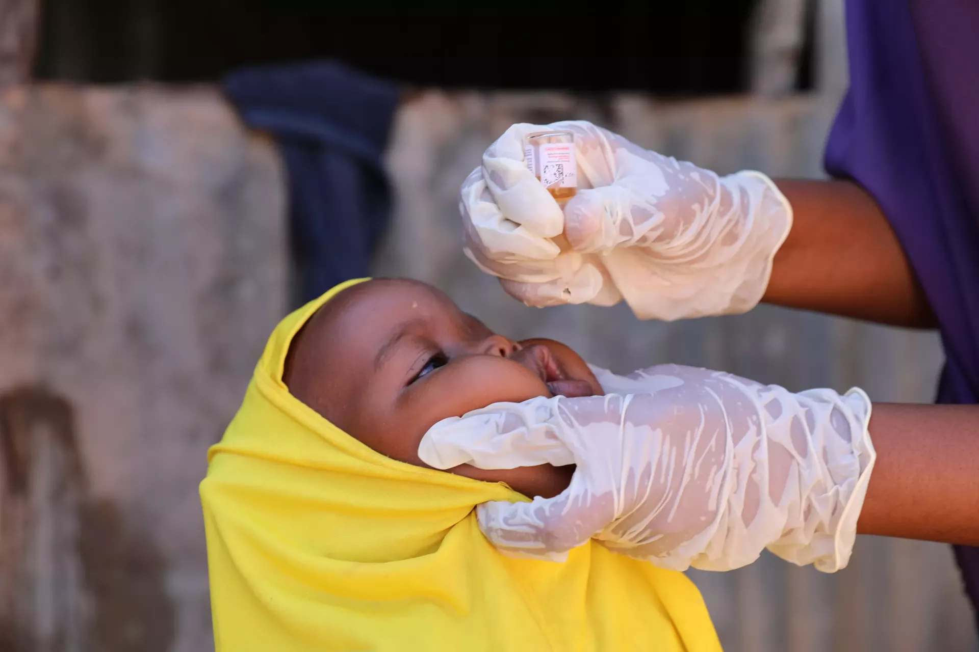 The Importance of Baby Vaccination Schedules in Somalia’s Healthcare Journey